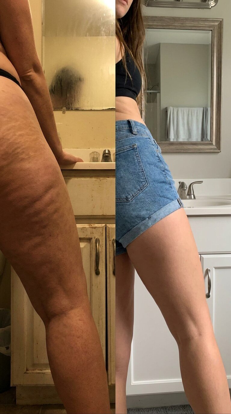 Cliente Patricia - piernas más firmes