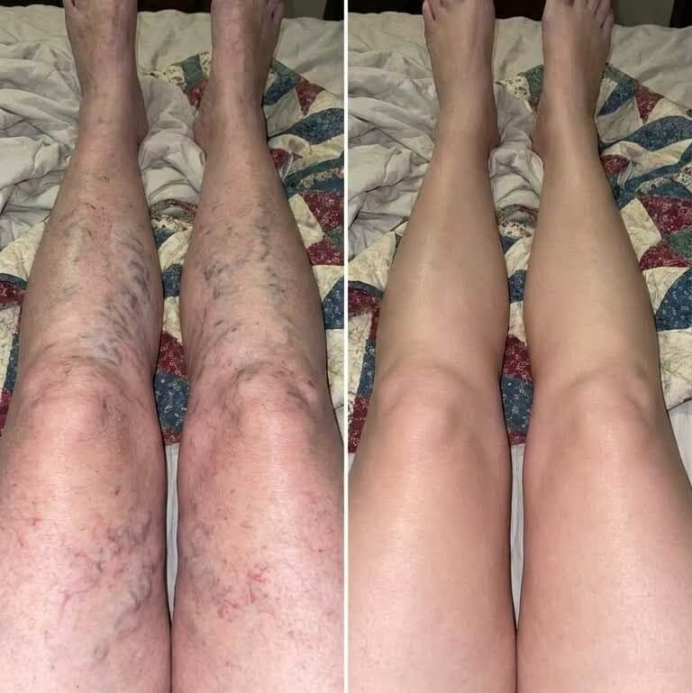Cliente Alicia - antes y después