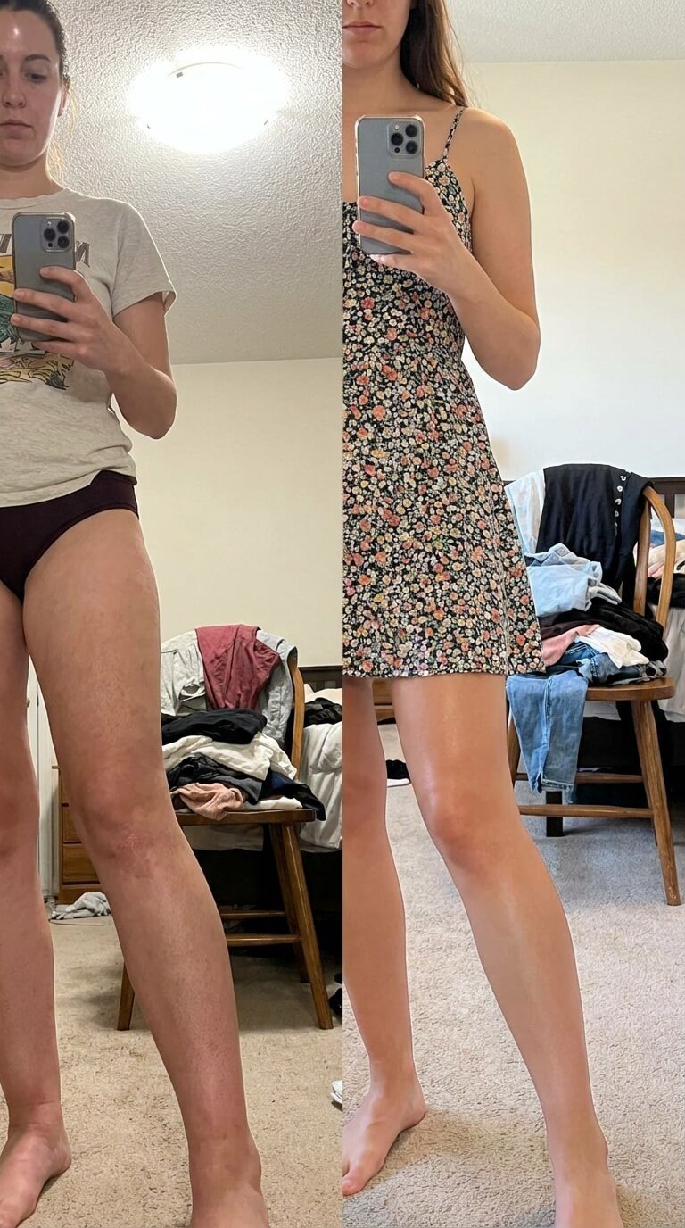 Cliente Inés - piernas ligeras